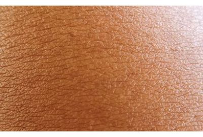 Preventing Skin Irritation from Incontinence: Care Tips